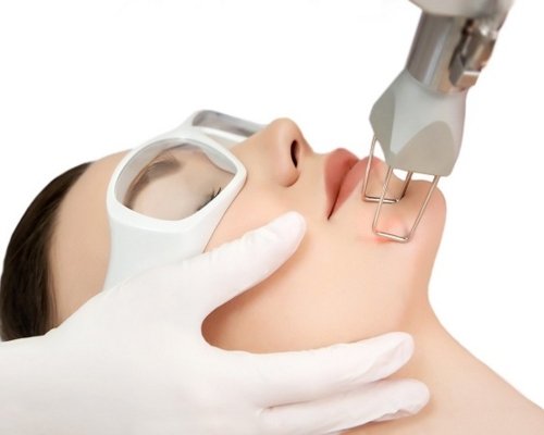 Fractional & CO2 Laser in Roorkee